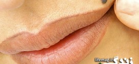 3 روش خانگي در رفع خال هاي صورت