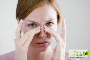 به 10 دلیل پف زیر چشم دارید